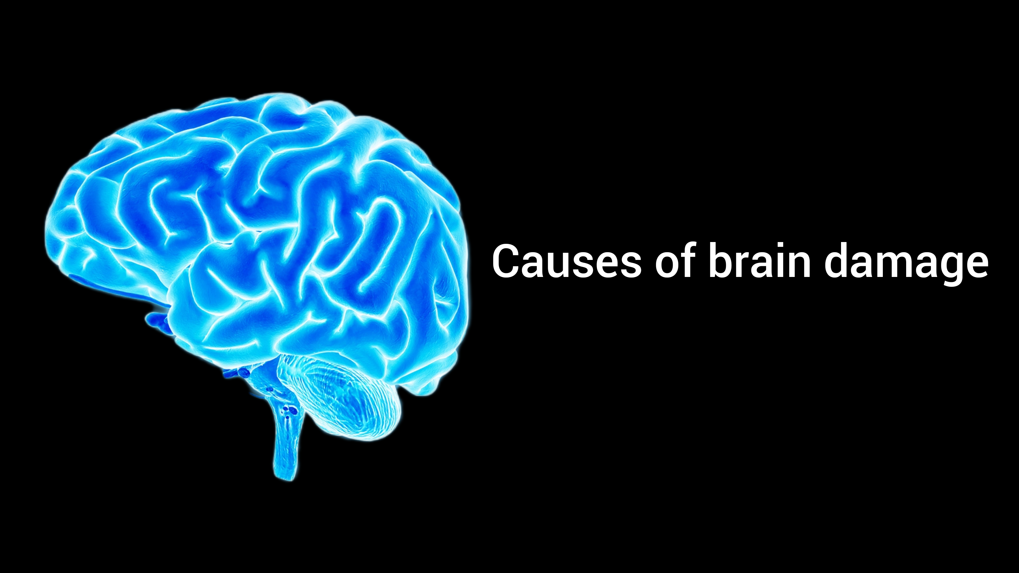 causes-of-brain-damage-by-syal-article